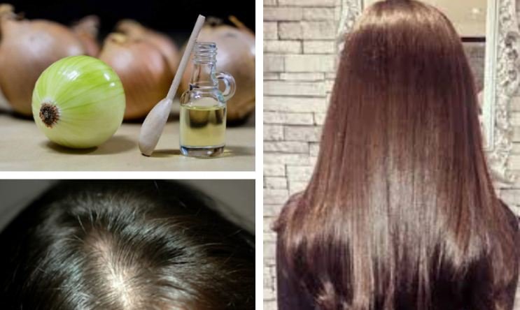 Home remedies for hair fall